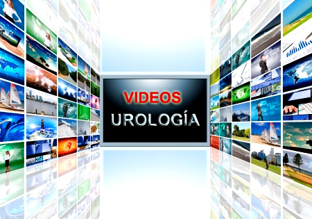 videos-urologia
